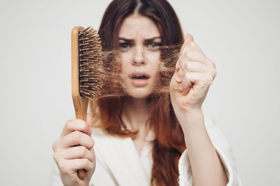 Hairloss
