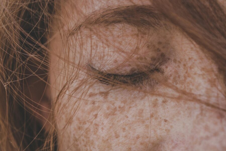 dermatology