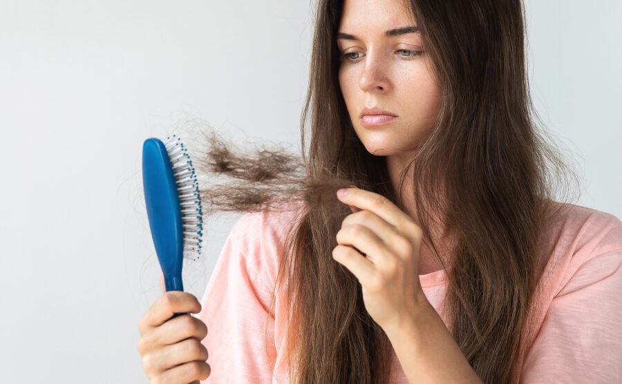 Hairloss