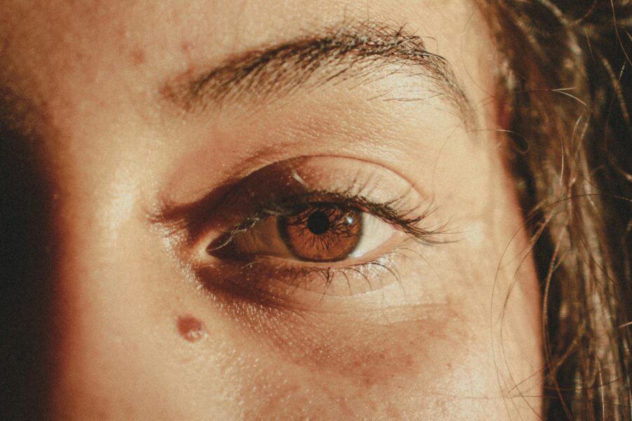 moles