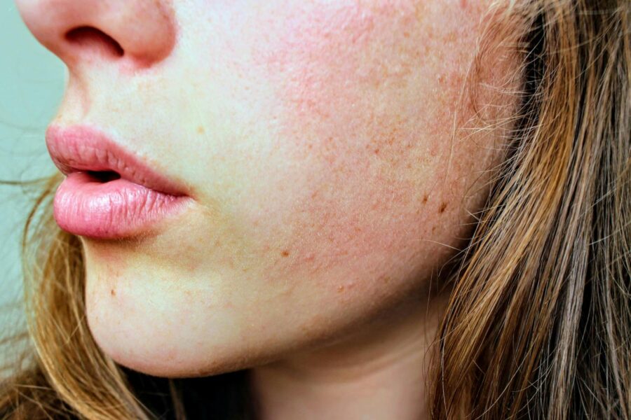 Skincare