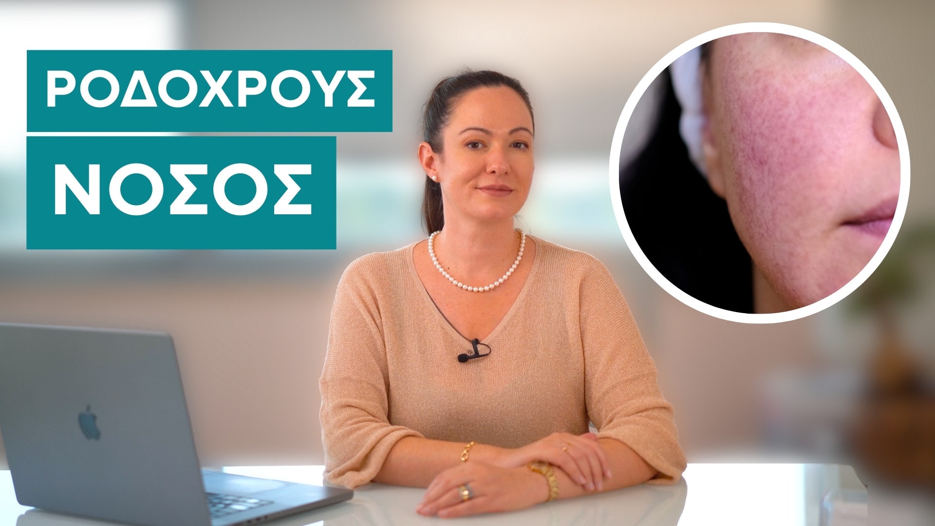 Rodoxrous nosos