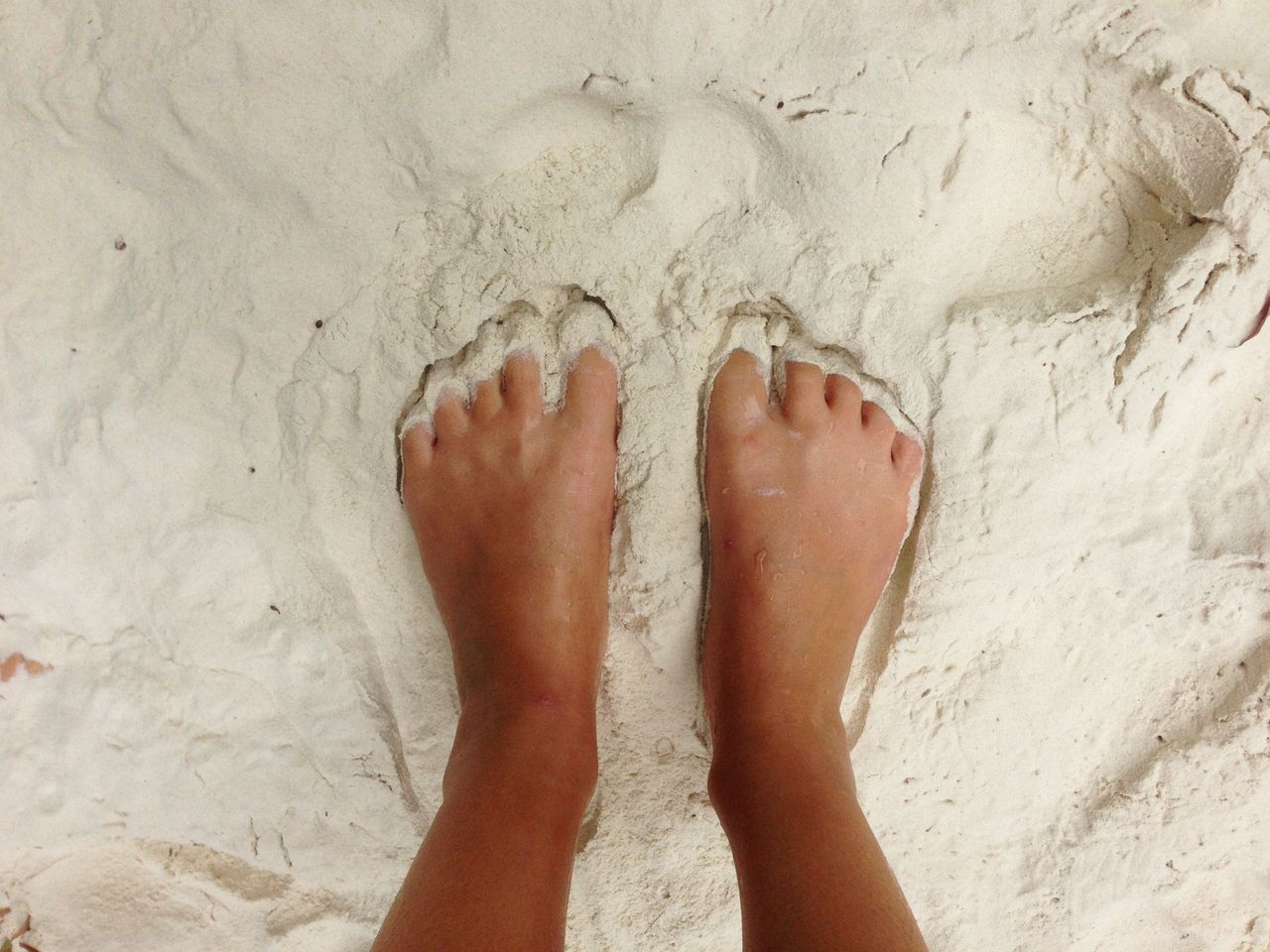 Mykitiasis